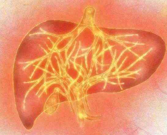 头发出油 表示你的肝火很旺 食疗可以解决