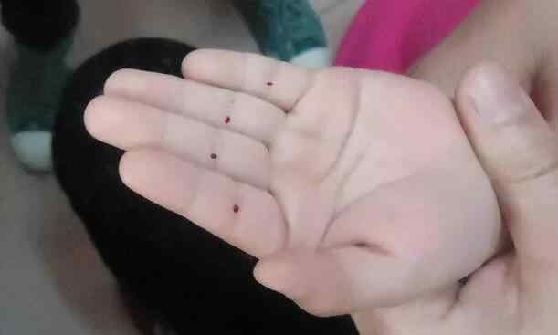 刺四缝.jpg 刺四缝.jpg