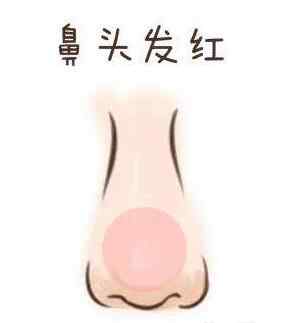 鼻头发红.jpg 鼻头发红.jpg