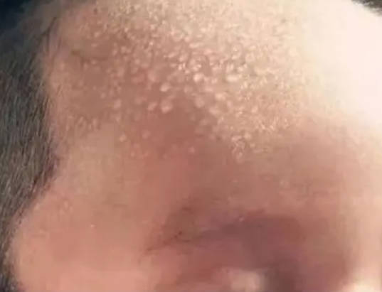 孩子反复发烧积食，身体这些地方会“亮红灯”