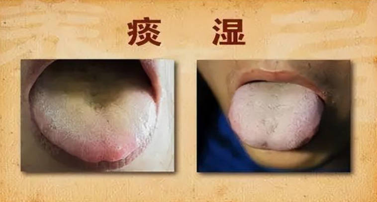 脾胃虚弱痰湿重吃什么药最好.jpg 脾胃虚弱痰湿重吃什么药最好.jpg