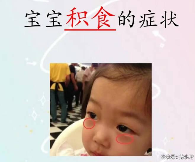 积食的症状有哪些？我用一罐山楂膏终结了孩子的痛苦！